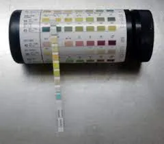 buy dengue detection test supplier
