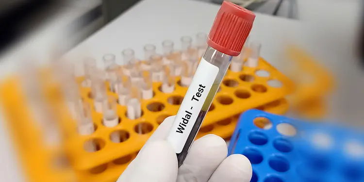 best hepatitis c rapid test kit